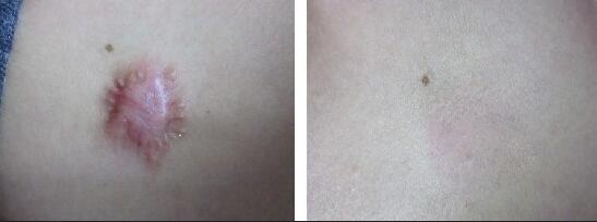 ۸
