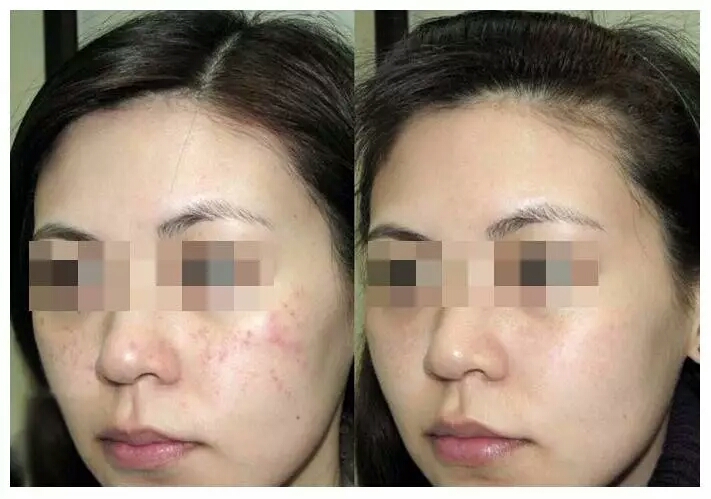 ����ȥ��ӡЧ��