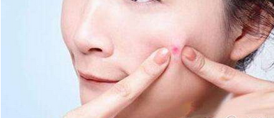 关于痤疮印产生的原因